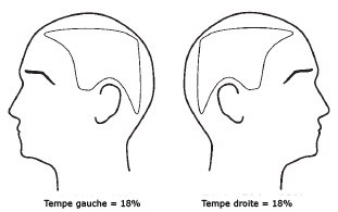 evaluation surface pelade